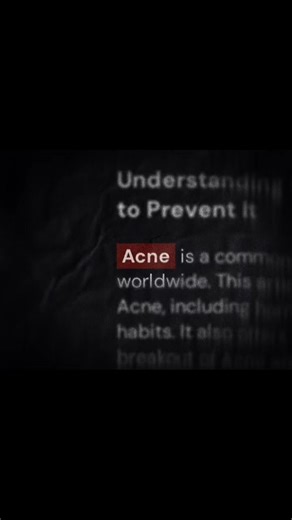 Effective Strategies for Managing Acne Prone Skin