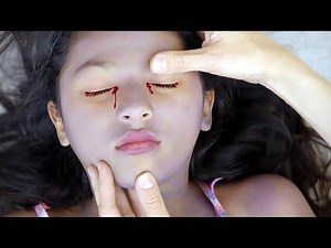 The girl choked on a hotdog causing her eyes to bleed