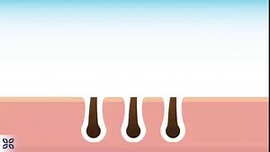 Shaving vs. Waxing vs. Laser Hair Removal? We know which one we prefer 😉 Watch on to find out why we love Laser Hair Removal so much! . . . . #laserhairremoval #waxing #shaving #thecosmeticclinic | The Cosmetic Clinic