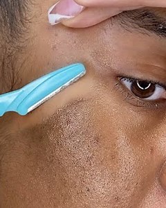 The satisfying process of dermaplaning for the first time! | MetDaan