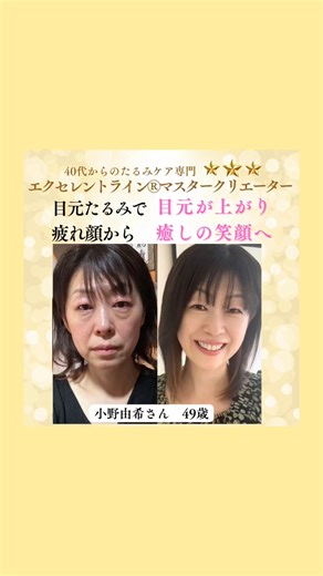 40代 顔のたるみ…美顔器じゃ変われなかった私が“自分の手だけ”で若返った方法｜表情筋・血流ケアで−5歳肌へ