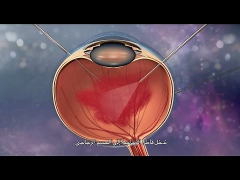 Vitreoretinal Disorder Surgery