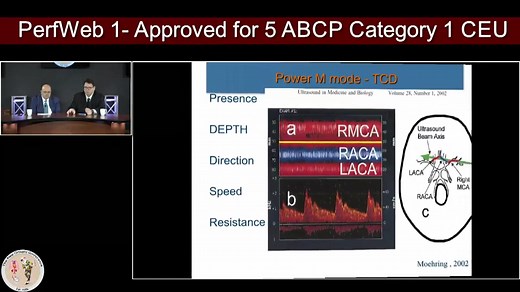 Transcranial Doppler TCD Basics 颅脑多普勒