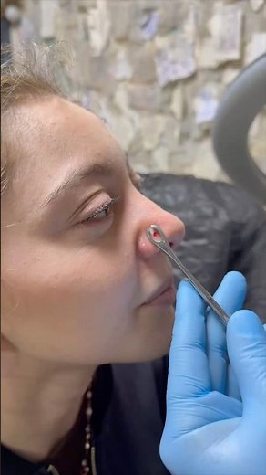 Our nostril nose piercing procedure 👹👹