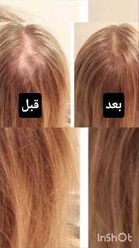وداعاً للفراغات والتساقط من أول أسبوع! طريقتي السرية في تحضير زيت إكليل الجبل في البيت 😱"