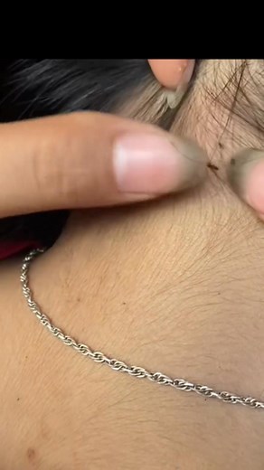 Krek kuto #kuto #lice | Juni Guchi