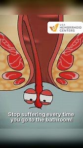 Recurring pressure, bleeding, or incomplete bowel movements? You might be overlooking internal hemorrhoids — which can silently worsen without external signs. Try HAE — a modern, non-invasive solution: ✔️ No surgery ✔️ No hospital stay ✔️ Covered by most insurance 👉 Tap “Learn More” and take the free symptom check today. | USA Hemorrhoid Centers