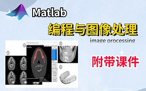 【Matlab编程与图像处理】以医学影像分析为实例，经由基础编程实现医学影像处理步骤，并据此建构3D模型，让你了解结合3d的重要性！-人工智能/matlab编程