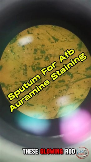 Sputum For AFB #AuramineStaining #microbiology