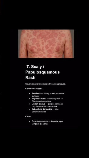 All types of rash #medicaleducation #doctor #health