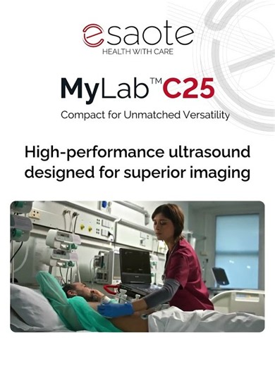 Esaote MyLab™ C25 – The Future of Smart Ultrasound Technology #diagnosticimaging #esaote