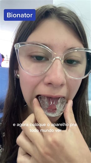 #CapCut #bionator#ortopediafacial#aparelho#odontopediatria
