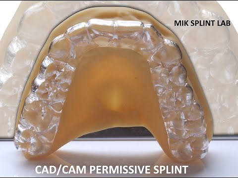 CAD/CAM Permissive Splint by MIK Dental Lab #TMJ #TMD