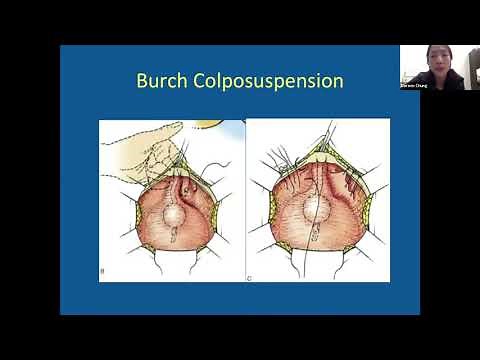 Surgery for Stress Urinary Incontinence - EMPIRE Urology Lecture Series