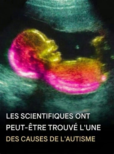 Cela peut tout changer 👇👀 | Codes de Jeunes