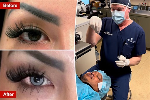 Doctor charges $6K per eye to change eye color forever: ‘This is scarier than any horror film’