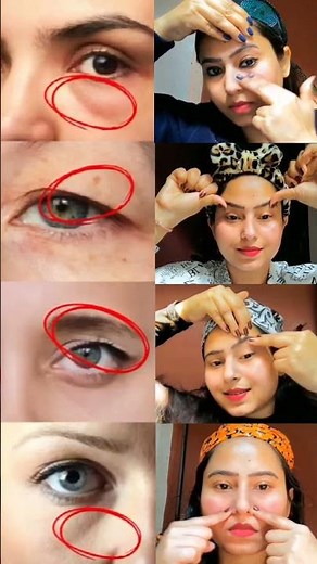 💫"Remove Dark Circles & PufFy EyesNaturally | Face Yoga For Under Eye Wrinkles #shorts