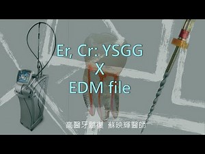 水雷射原理/根管沖洗與EDM旋轉器械