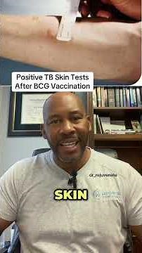 Medicine: Beyond the Basics. Positive TB test and BCG vaccines ‪@Dr_rejuvenate‬