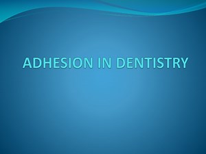 ADHESION IN DENTISTRY - SlideServe