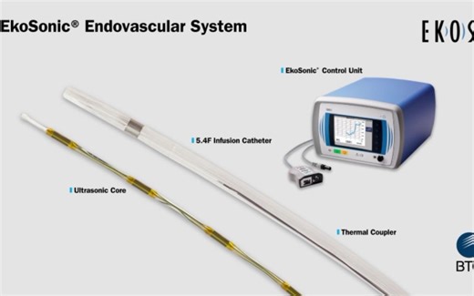 EKOS Device in Action 超声溶栓