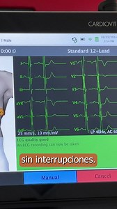 Con el CARDIOVIT FT-1, hacer un ECG nunca ha sido tan fácil: conecte, presione "Grabar" y guarde. | Schiller Americas