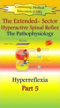 The Hyperreflexia (5).. The Extended Hyperactive Spinal Reflex
