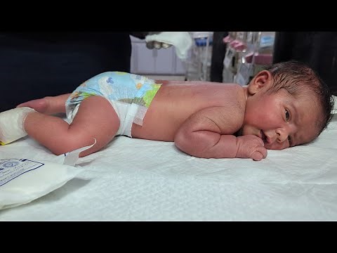 Newborn Head to Toe Assessment | Neonatal Physical Exam ❤️💪#assessment #newbornbaby #nicu
