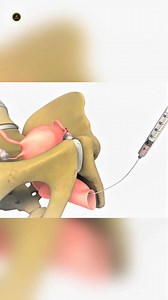 2M views · 10K reactions | IVF procedure #factsvideo #viralfact #science #facts #reel #medicalfact #biology | Crazy factor | Facebook