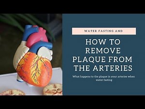 THE #1 WAY TO REMOVE PLAQUE FROM THE ARTERIES