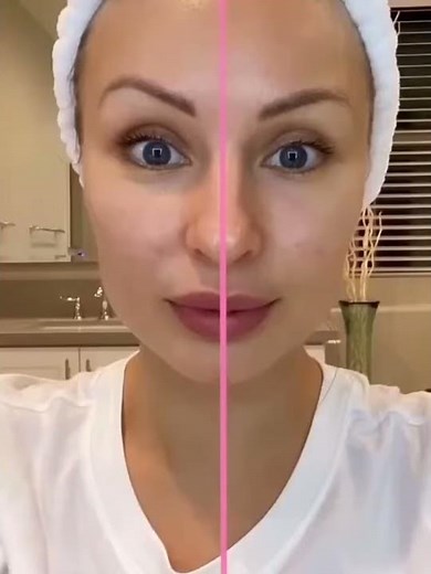 Zemits Adrinox ProGloves - Microcurrent Lifting Treatment with Gloves