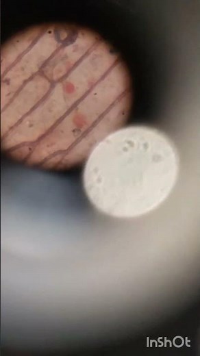 Onion cell mount Temporary slide of onion peel off class 9th NCERT chapter 5