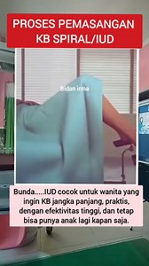 Proses pemasangan KB spiral/IUD #fyp #fyi #reelsfb #reelsviral #jangkauanluas #monetisasi #videoedukasi #edukasikesehatan #bidanirma | Bidan Irma