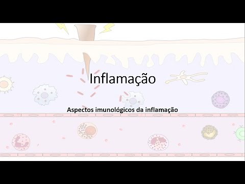 Inflamação, Resposta inflamatória, Quimiocinas; Migração leucocitária; Fagocitose.