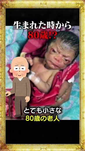 生まれた時から80歳の赤ちゃん！？