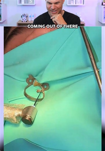 Root Canal Procedure: What Really Happens? Dentist Explains