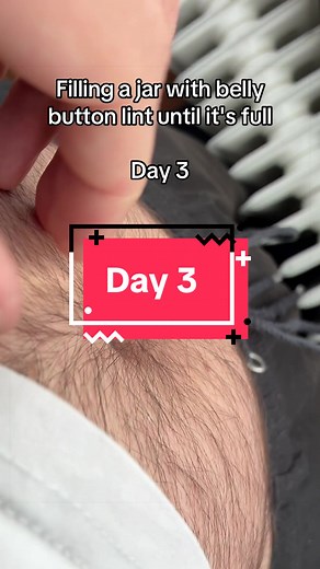 Collecting Belly Button Lint: Day 3 Fluff Accumulation