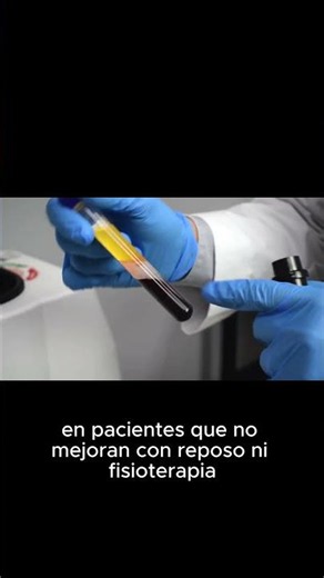 Cómo Curar una Tendinitis Crónica sin Cirugía con PRP (Plasma Rico en Plaquetas)