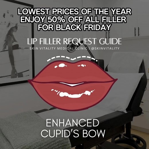Transform your look with Juvederm® this Black Friday. Skin Vitality’s 50% OFF filler event is here — plump lips, smooth wrinkles, contour cheeks. Your most confident self is only one appointment away. | Skin Vitality Medical Clinic | Facebook