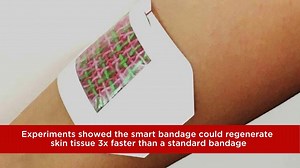 Smart bandage could promote better, faster healing – Lifeboat News: The Blog