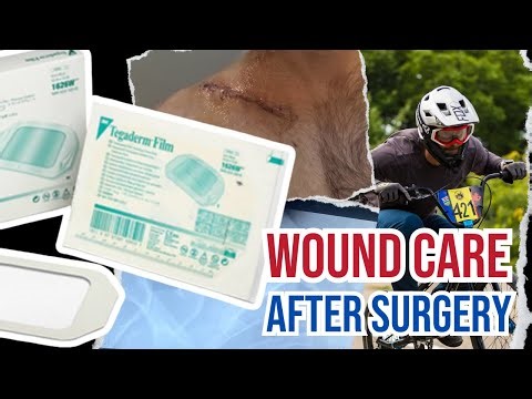 Wound Care After Surgery