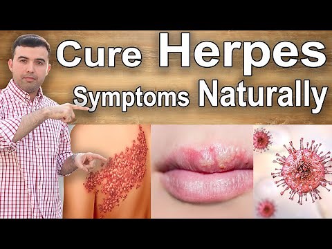 Cure Herpes At Home - How to Heal and Treat Herpes Naturally