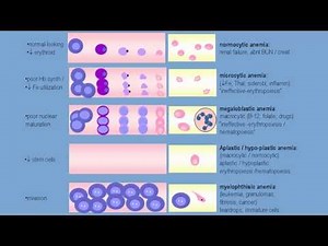 Anemia of decreased red cell production