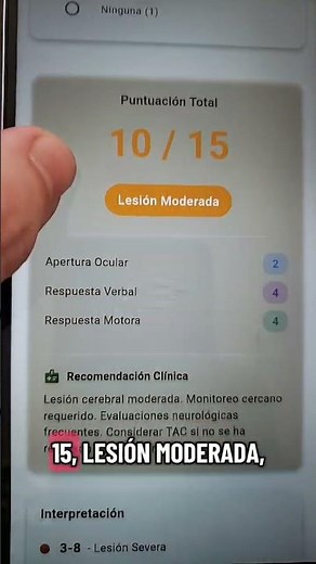 usando la escala de Glasgow pediátrico #auximedical #enfermeria