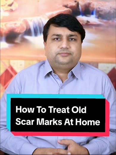 Scar Eraser! Best Cream for Acne Scars & Stretch Marks (ScarAway vs. ScarFade Review) ✨🩹🇵🇰 Dealing with old acne marks or stretch marks? Dr. Zain Ul Abidin, your dermatologist, reviews the ultimate showdown: ScarAway Gel vs. ScarFade UV Gel! I'll tell you which single cream is the BEST for effectively removing scar marks, post-acne scars, and stretch marks, based on ingredients and proven results. Stop wasting money, start healing! SEO-Orientags: #ScarRemoval #AcneScars #StretchMarks #ScarAwa