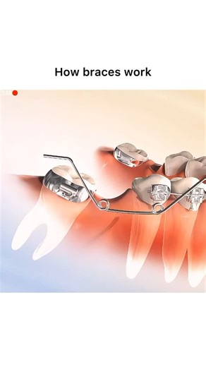 Animations on Instagram: "Follow @surgicalanimation for more! 🏥"