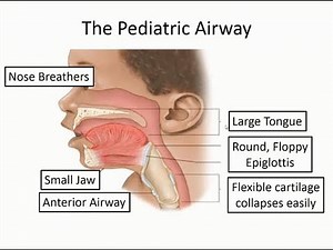 Pediatric Respiratory Emergencies Training