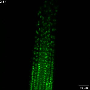 File:Developmental-Nuclear-Localization-and-Quantification-of-GFP-Tagged-EB1c-in-Arabidopsis-Root-Using-Video1.ogv - Wikimedia Commons