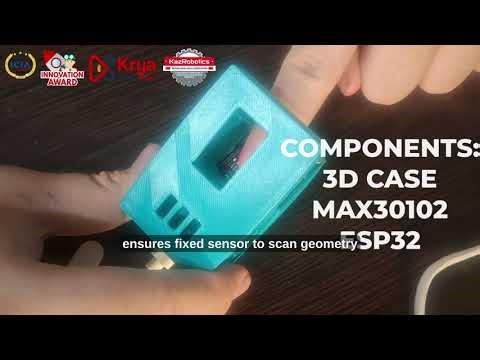 Non-Invasive Blood Glucose Monitoring Using NIR Spectroscopy and Machine Learning