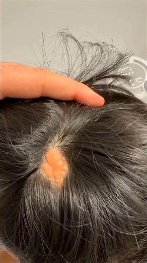 Small Bump on Your Head? Don’t Ignore This #shortsvideo